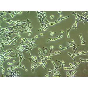 HT115 Cell:人结肠癌细胞系