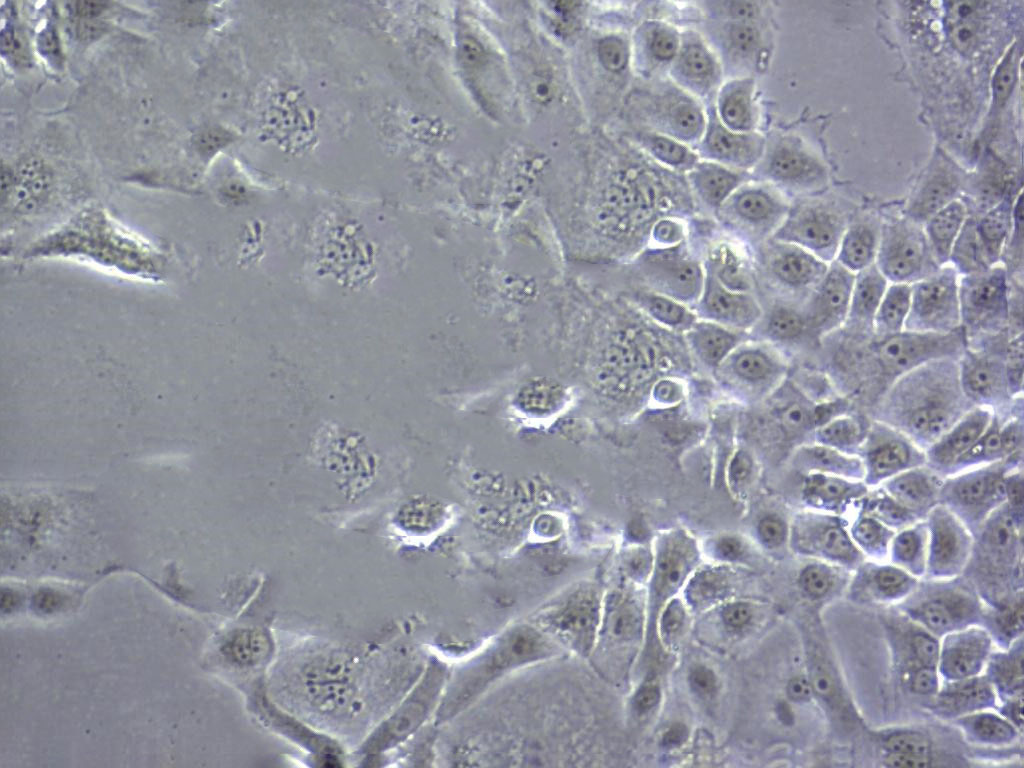 DBTRG-05MG Cell:人脑胶质母细胞瘤细胞系,DBTRG-05MG Cell