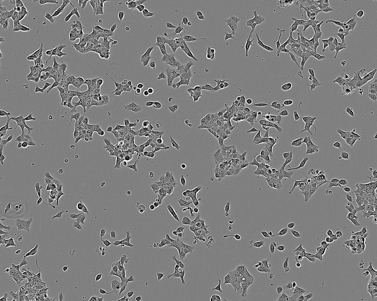 MDA-MB-436 Cell:人乳腺癌细胞系,MDA-MB-436 Cell