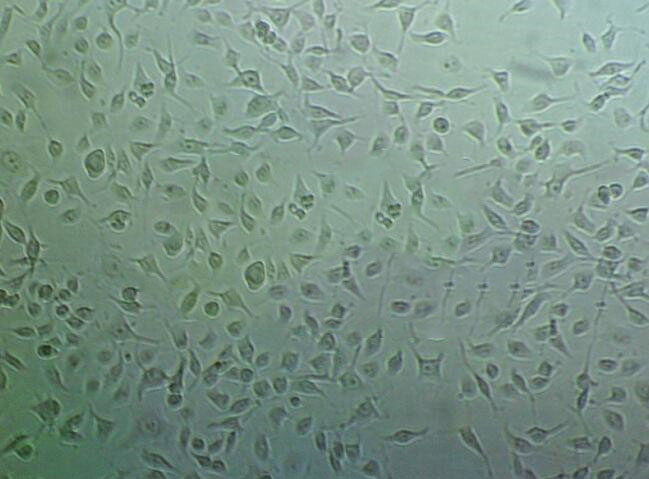 DU4475 Cell:人乳腺上皮细胞系,DU4475 Cell