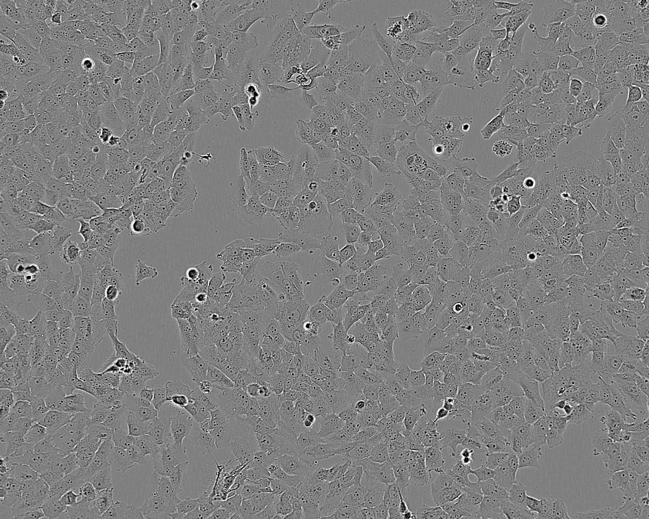 HCC1569 Cell:人乳腺癌細胞系,HCC1569 Cell