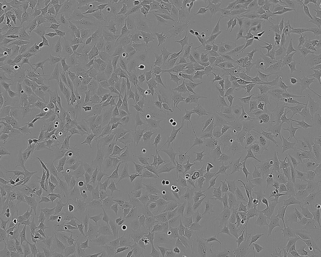 OVTOKO Cell:人卵巢透明细胞癌细胞系,OVTOKO Cell