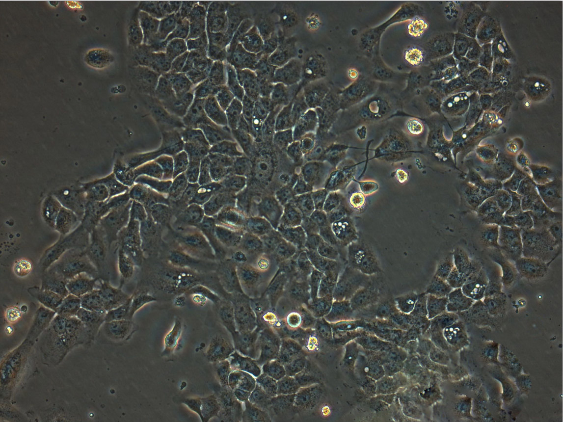 NCI-H250 Cell:人小细胞肺癌细胞系,NCI-H250 Cell