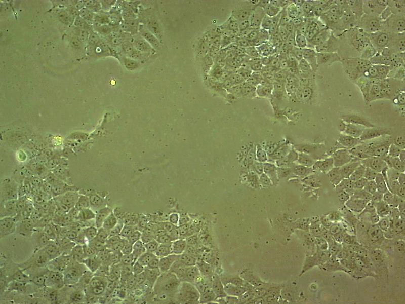 PG [Human lung carcinoma] Cell:人巨細(xì)胞肺癌細(xì)胞系,PG [Human lung carcinoma] Cell