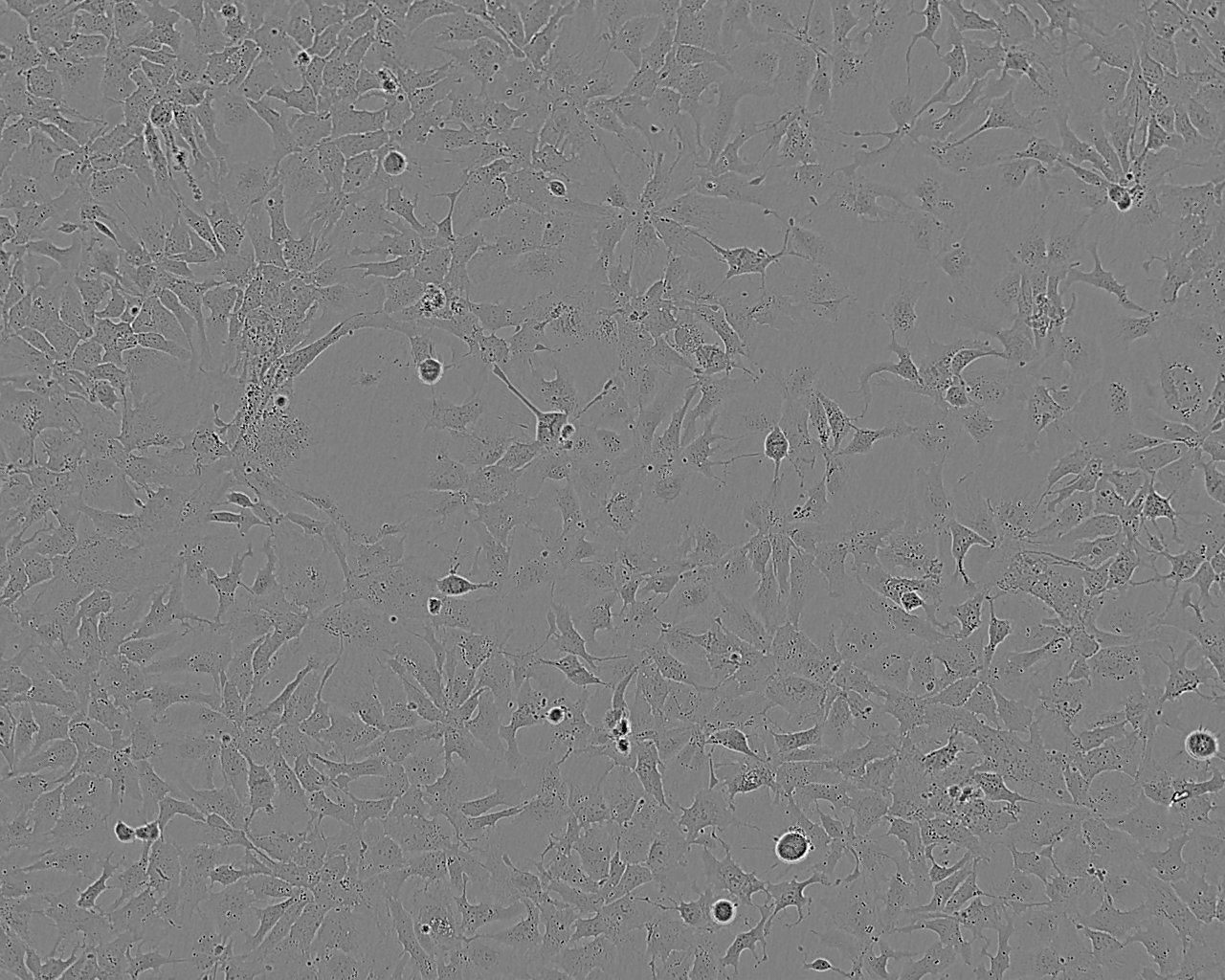 MUG-Chor1 Cell:人骶骨脊索瘤细胞系,MUG-Chor1 Cell