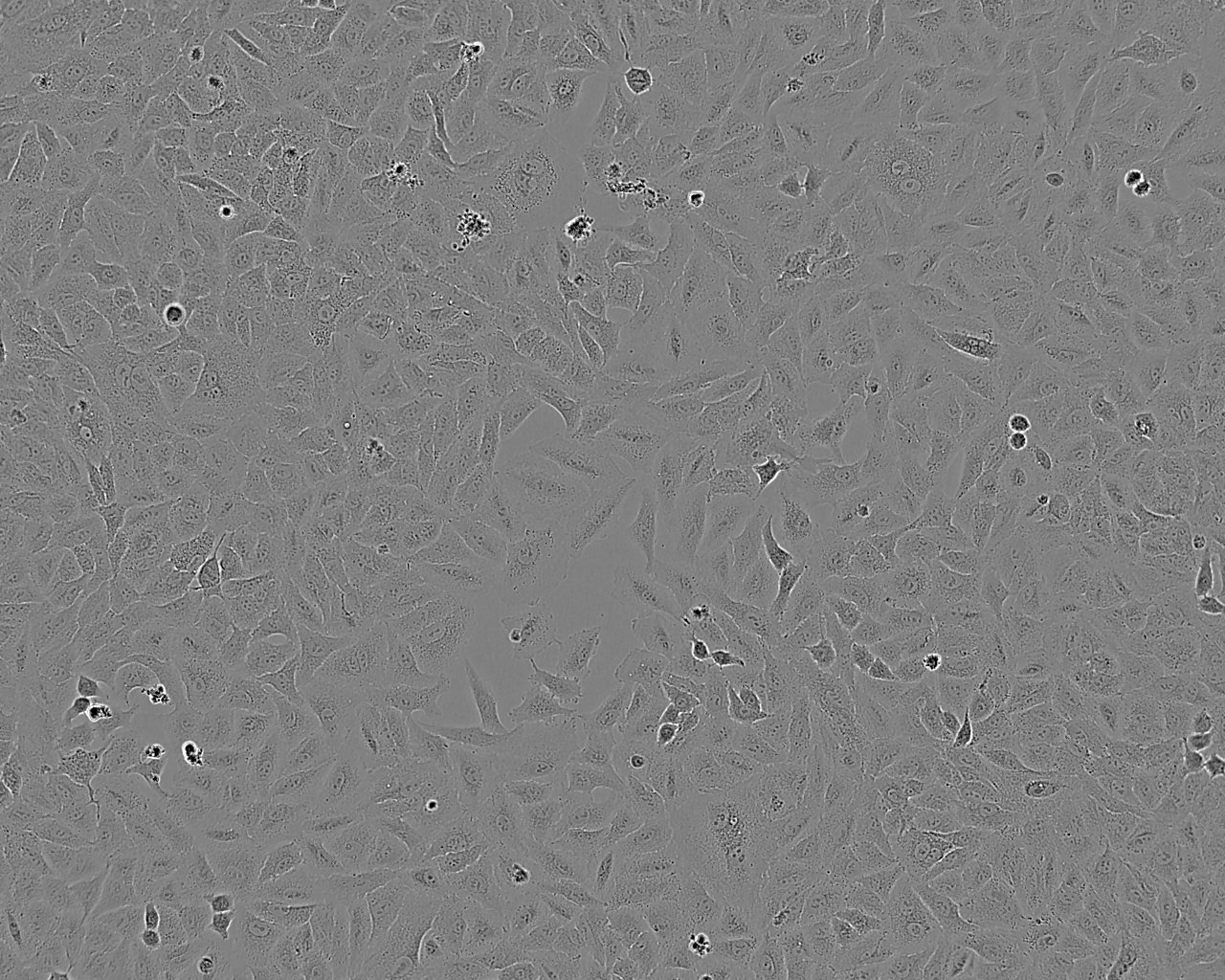 SEG-1 Cell:人食管腺癌细胞系,SEG-1 Cell