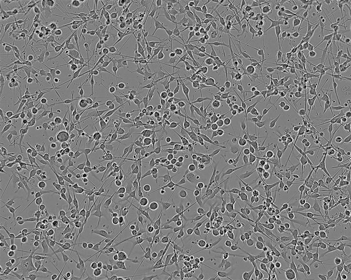 MC57G Cell:小鼠纤维肉瘤细胞系,MC57G Cell