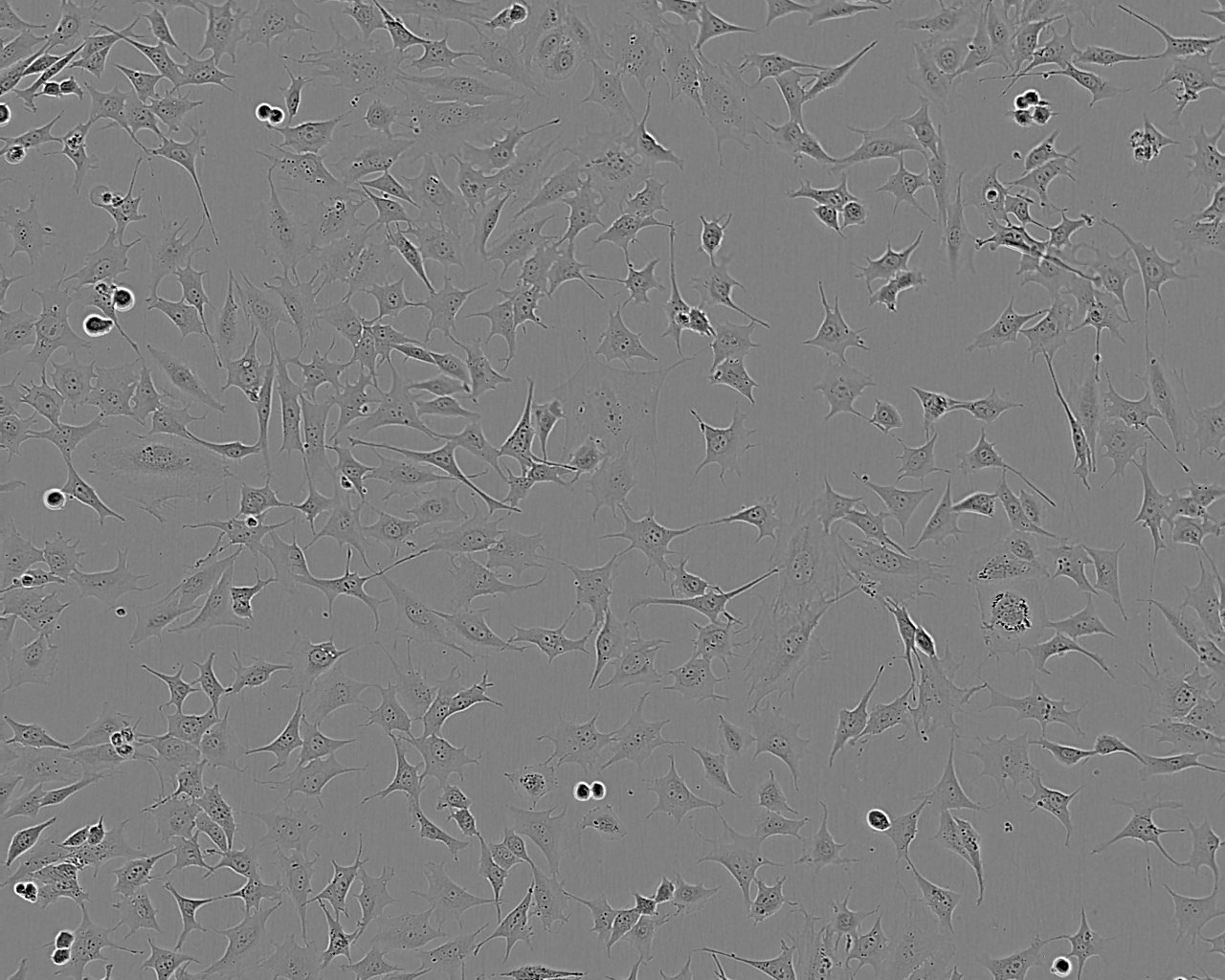 CMT167 Cell:小鼠肺癌细胞系,CMT167 Cell