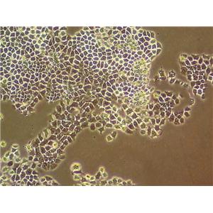 EOMA Cell:小鼠血管内皮瘤细胞系,EOMA Cell