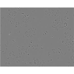 WB-F344 Cell:大鼠肝上皮样干细胞系
