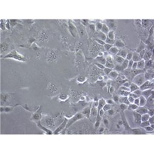 DBTRG-05MG Cell:人脑胶质母细胞瘤细胞系