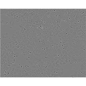GB-1 Cell:人脑胶质母细胞瘤细胞系