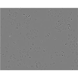 KS-1 [Human glioblastoma] Cell:人腦膠質(zhì)母細(xì)胞瘤細(xì)胞系