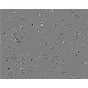 UM-UC-14 Cell:人肾癌细胞系