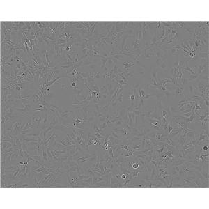 KYSE-510 Cell:人食管鳞癌细胞系