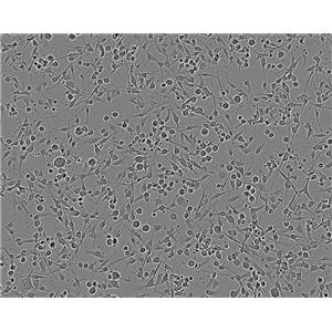 MC57G Cell:小鼠纤维肉瘤细胞系