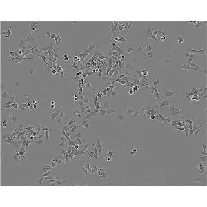 Sf21 Cell:昆虫卵巢细胞系