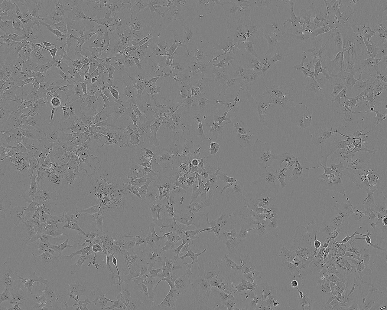 SPC-A1 Cell:人肺腺癌细胞系,SPC-A1 Cell