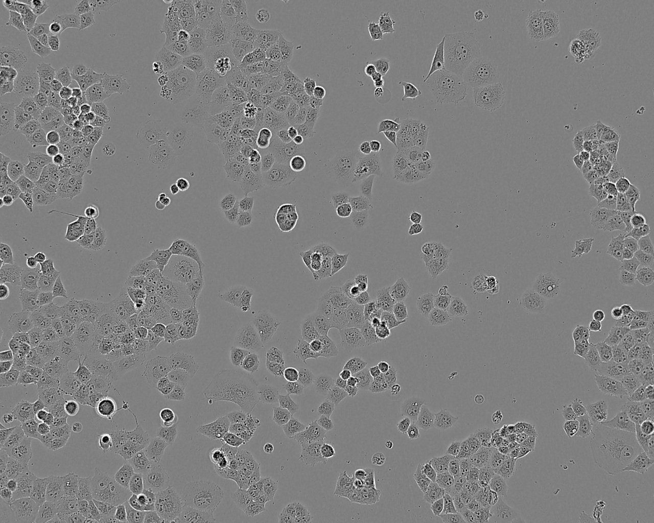 SF763 Cell:人脑瘤细胞系,SF763 Cell