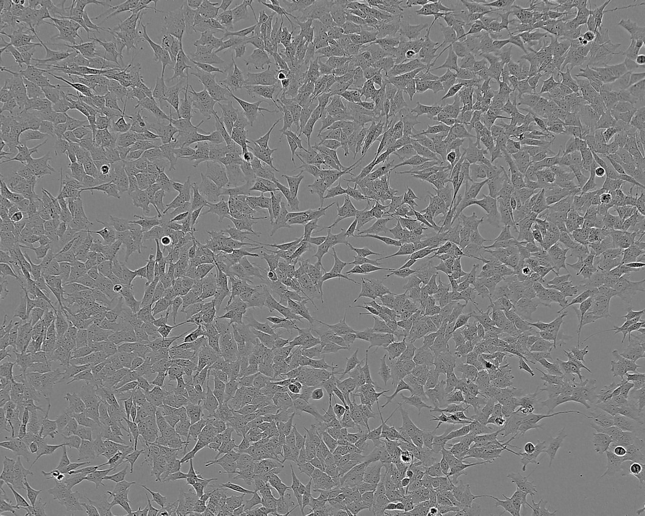 CBRH-7919 Cell:大鼠肝癌细胞系,CBRH-7919 Cell