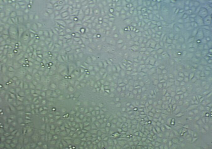 SUP-M2 Cell:人间变性大细胞系,SUP-M2 Cell