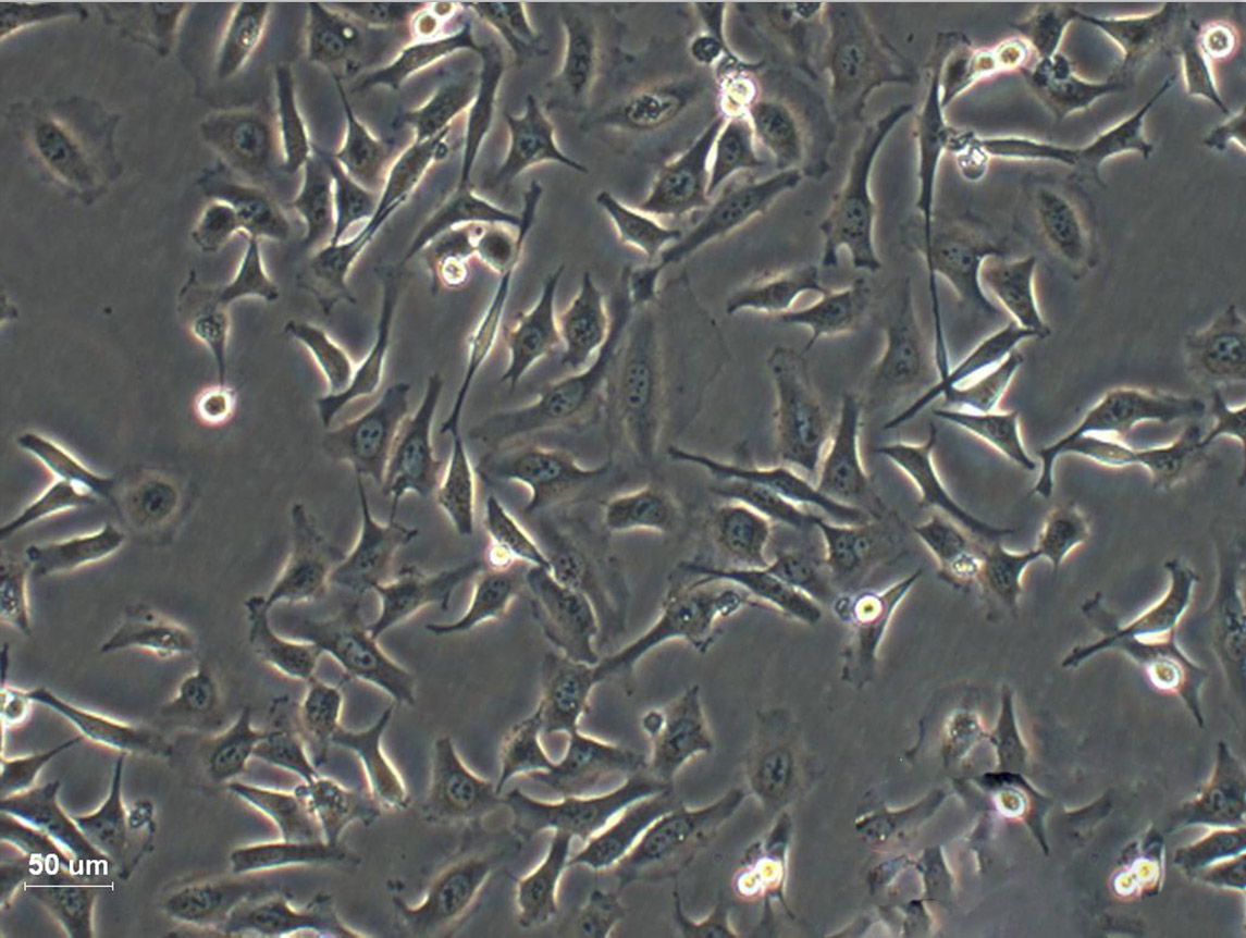 AC29 Cell:小鼠恶性间皮瘤细胞系,AC29 Cell