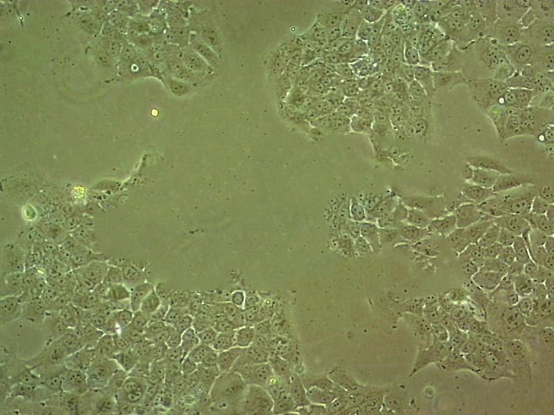 T84 Cell:人结肠腺癌肺转移细胞系,T84 Cell