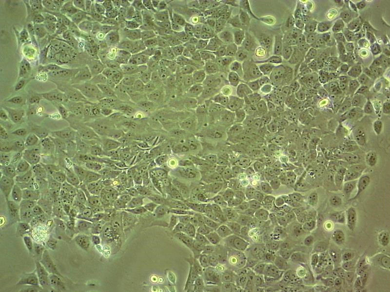 EC-GI-10 Cell:人食管鳞状细胞癌细胞系,EC-GI-10 Cell