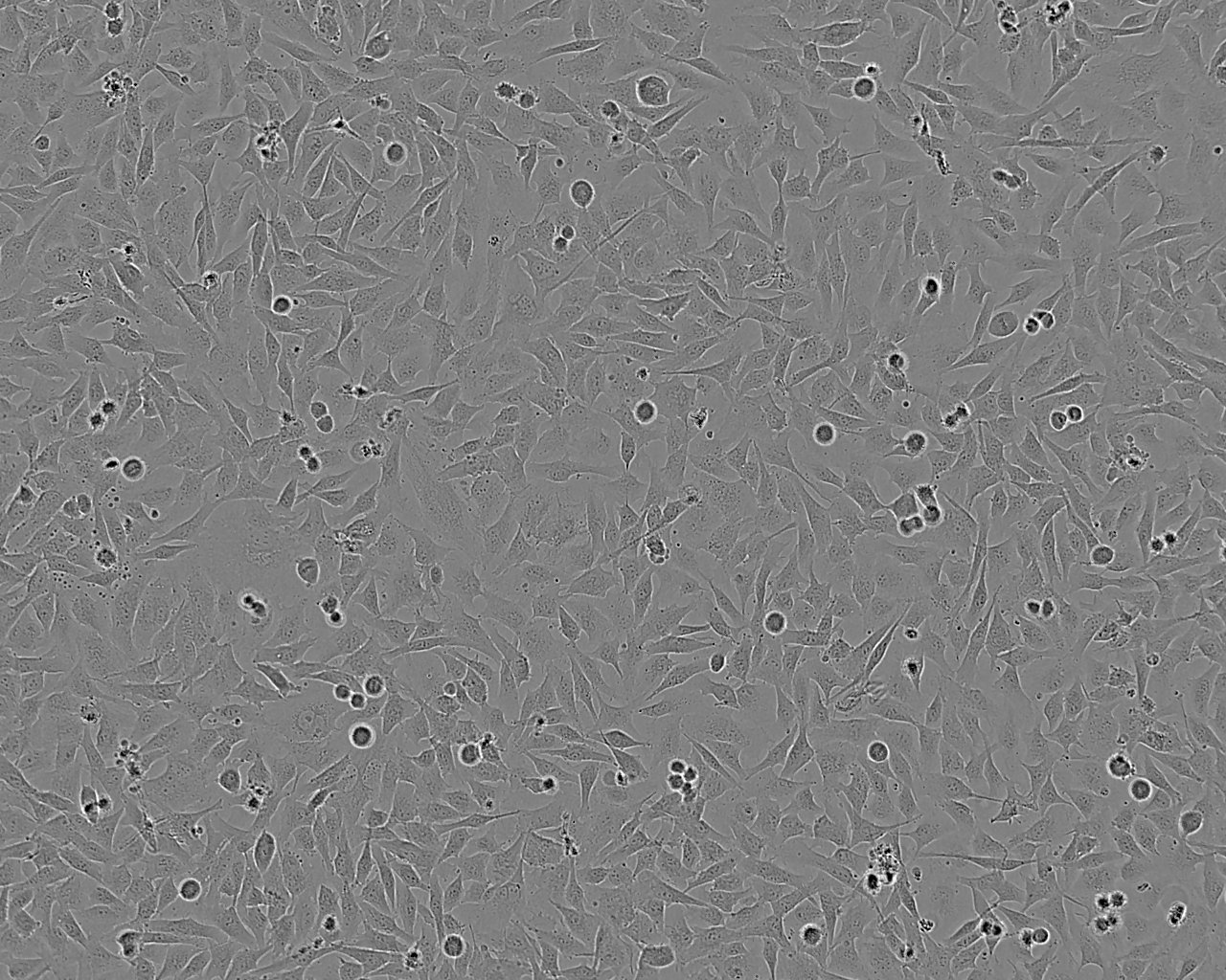 WERI-Rb-1 Cell:人视网膜母细胞瘤细胞系,WERI-Rb-1 Cell