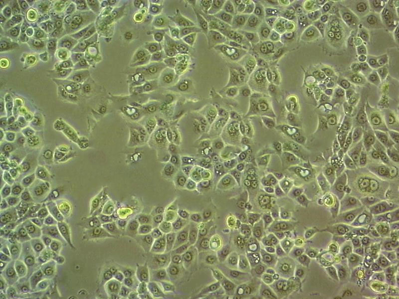 SK-NEP-1 Cell:人肾母细胞瘤细胞系,SK-NEP-1 Cell