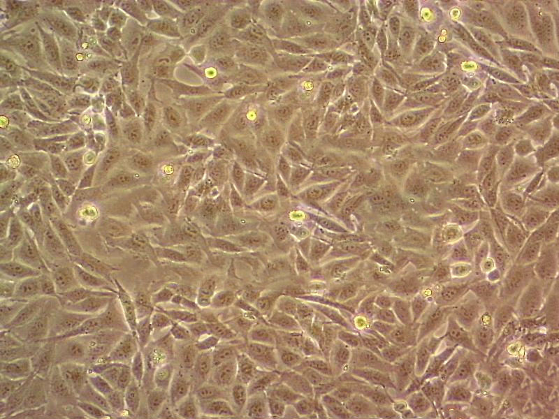 HCC2935 Cell:人肺癌细胞系,HCC2935 Cell