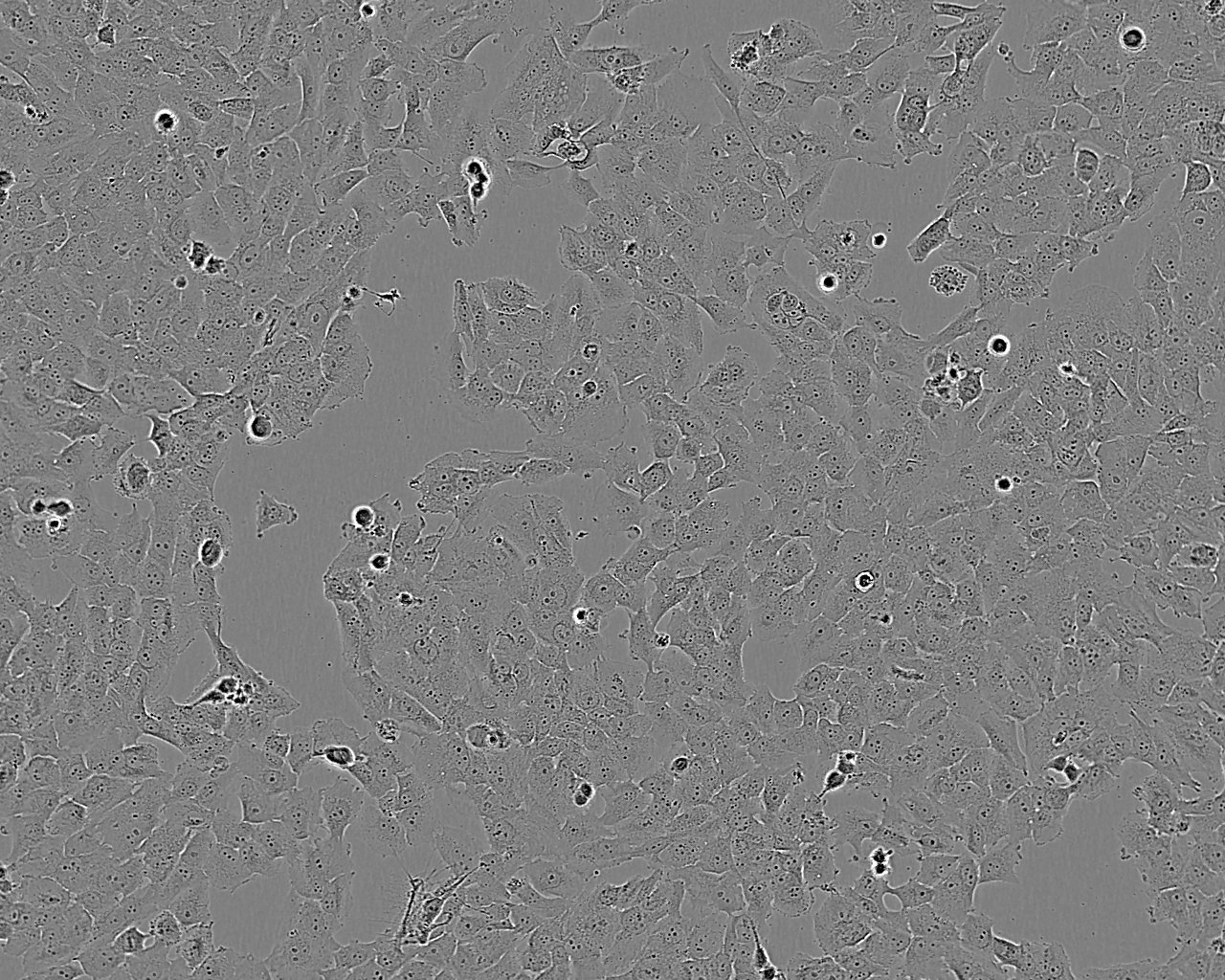 NCI-H1666 Cell:人肺支气管癌细胞系,NCI-H1666 Cell