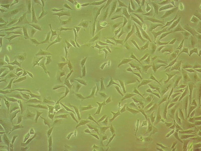 NCI-H1435 Cell:人非小细胞肺癌细胞系,NCI-H1435 Cell