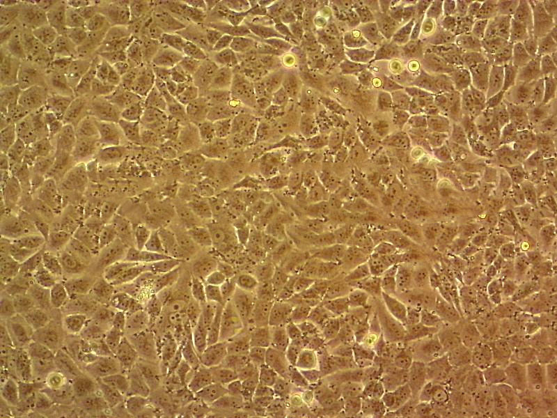 NCI-H1869 Cell:人肺癌細胞系,NCI-H1869 Cell