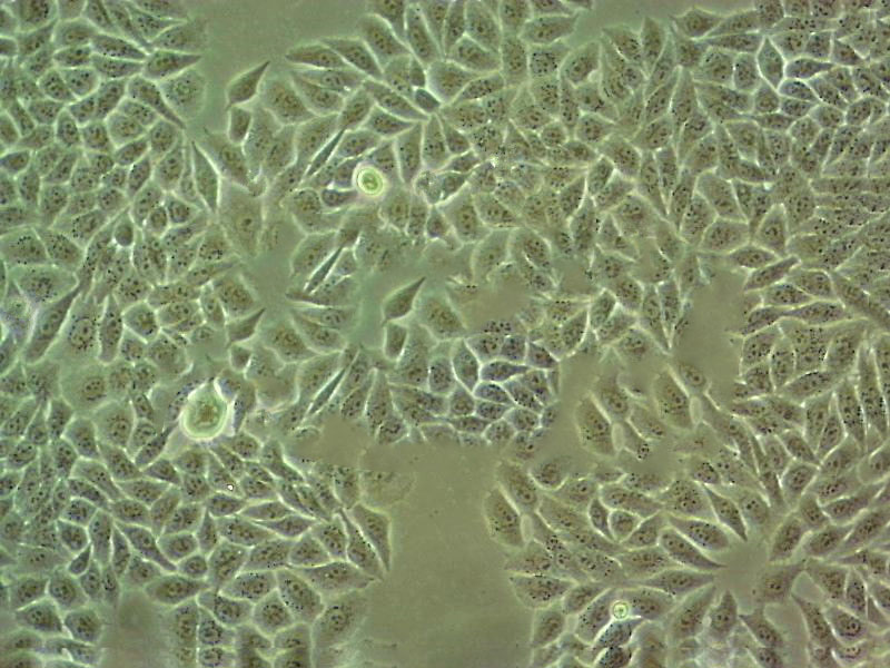 NCI-H2228 Cell:人非小细胞肺癌细胞系,NCI-H2228 Cell