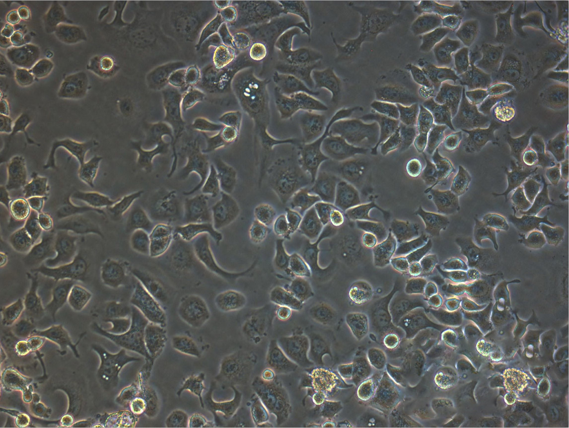 NCI-H209 Cell:人小细胞肺癌细胞系,NCI-H209 Cell