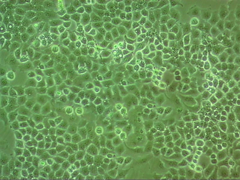 NCI-H2141 Cell:人小细胞肺癌细胞系,NCI-H2141 Cell