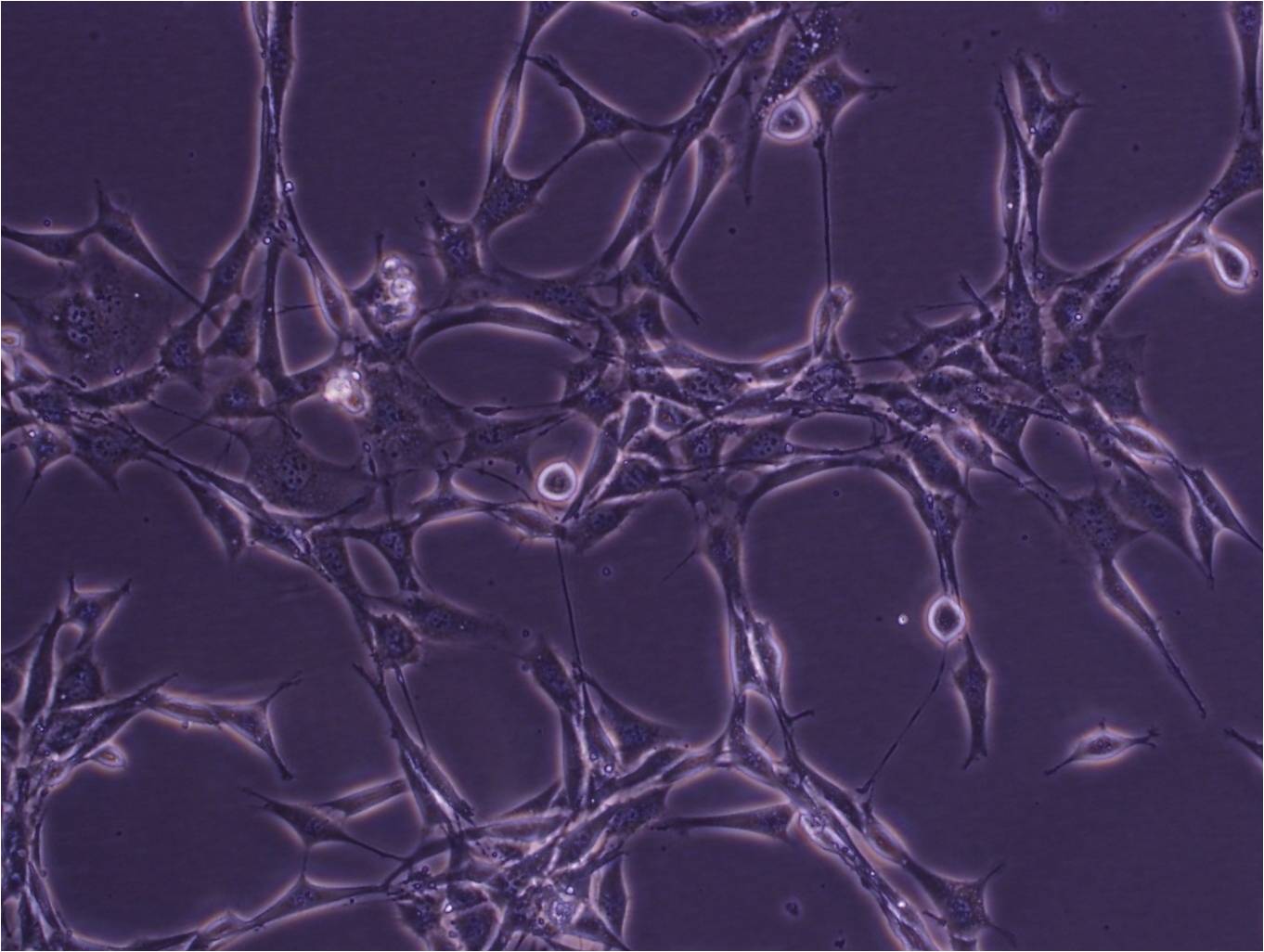 NCI-H2171 Cell:人小细胞肺癌细胞系,NCI-H2171 Cell