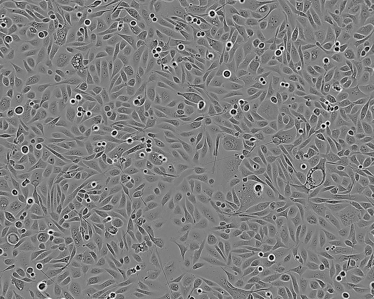 NCI-H889 Cell:人肺癌细胞系,NCI-H889 Cell