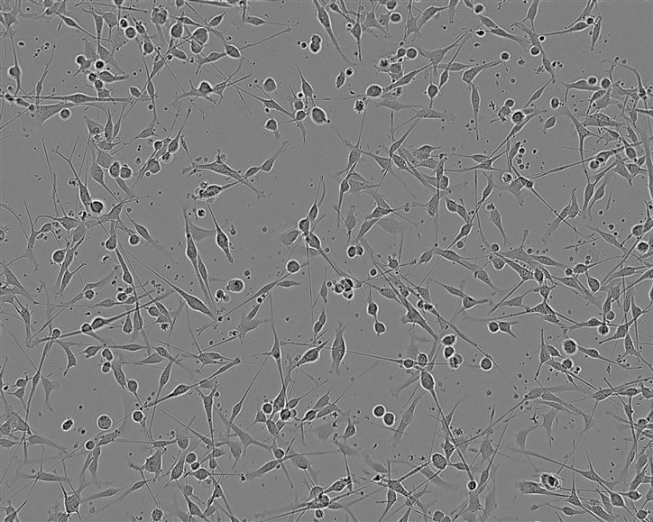 NCI-H2107 Cell:人小细胞肺癌细胞系,NCI-H2107 Cell