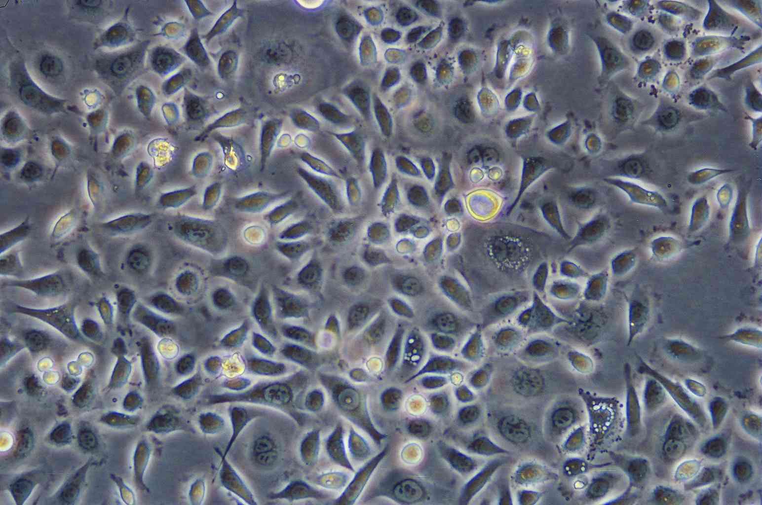 NCI-H526 Cell:人肺癌细胞系,NCI-H526 Cell