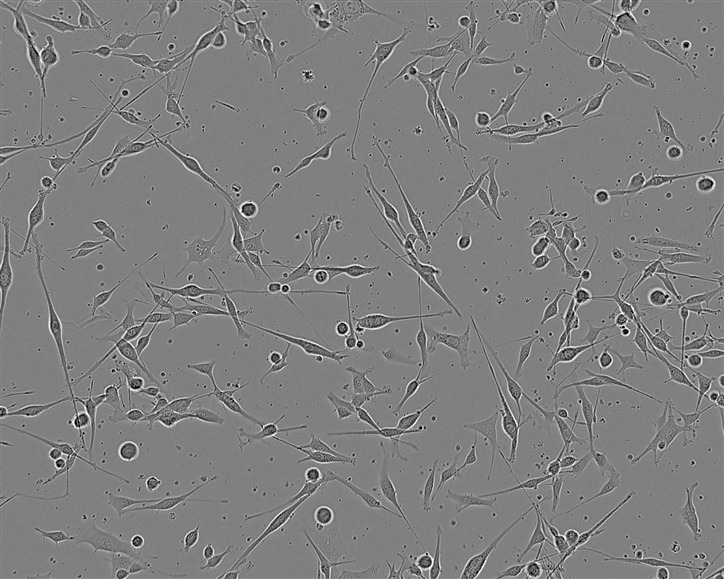 PSN1 Cell:人胰腺癌细胞系,PSN1 Cell