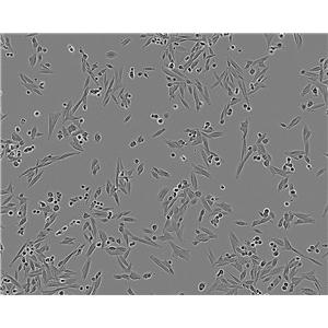 TSCC1 Cell:人源口腔鳞状细胞系