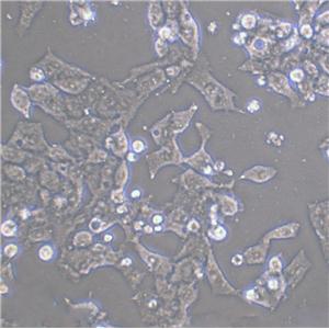 ACHN Cell:人肾细胞腺癌细胞系