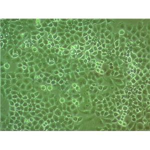 NCI-H2141 Cell:人小细胞肺癌细胞系