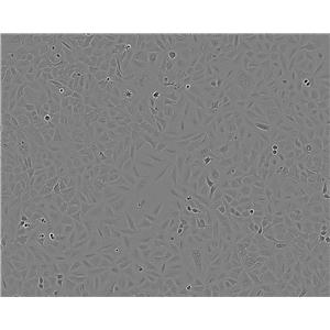 NCI-H2196 Cell:人小细胞肺癌细胞系