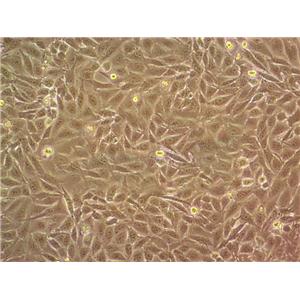 NCI-H82 Cell:人小细胞肺癌细胞系