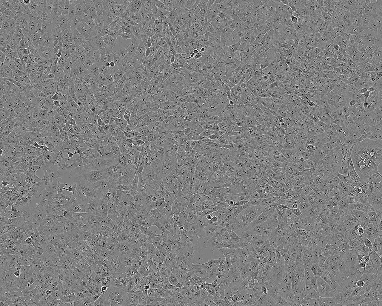 MV4-11 Cell:人急性單核細胞系,MV4-11 Cell