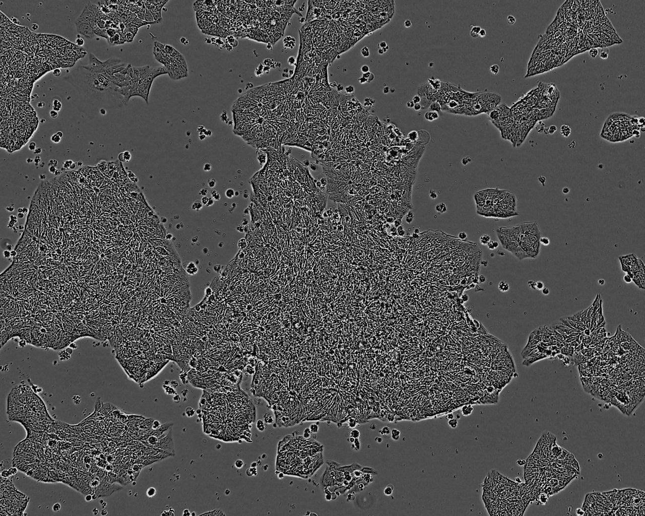 NGP Cell:人神经母细胞系,NGP Cell