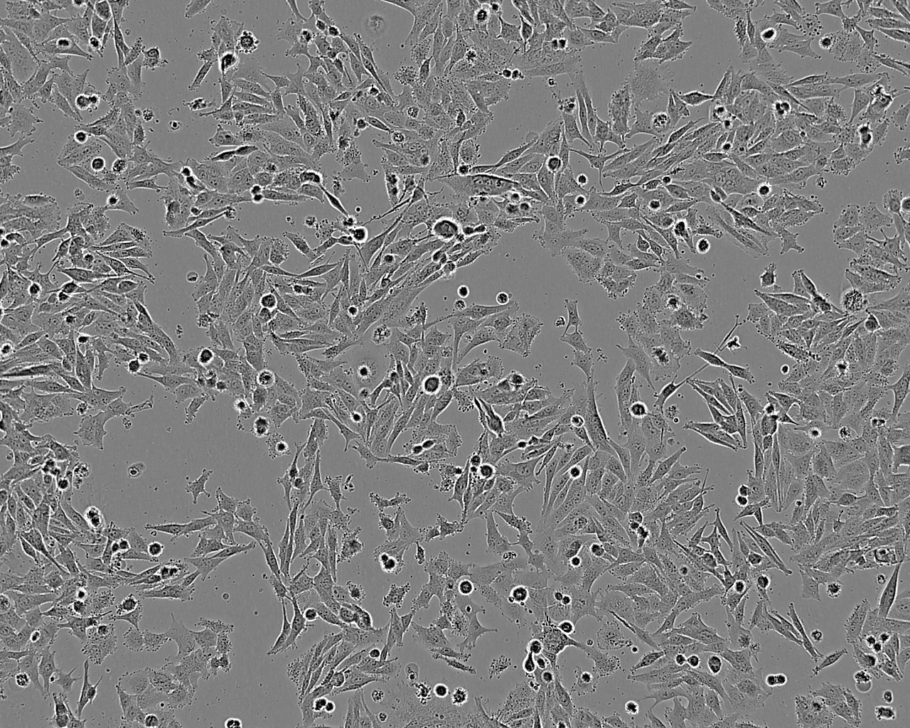 SLMT-1 Cell:人食管鳞癌细胞系,SLMT-1 Cell